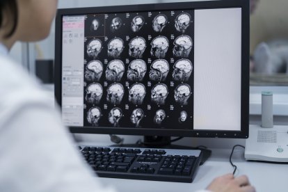 Un doctor mirando una prueba diagnóstica por imagen rápida del cerebro de un paciente
