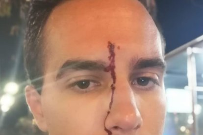 El vecino de Cunit sufrió una herida en la frente.