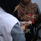 Fotografía tomada el 11 de julio en la ciudad de Gaza de Nour Al-Shaer, de ocho meses de edad, con desnutrición grave.