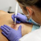 Una enfermera del Hospital de Igualada realiza la micropigmentación del pezón y la areola a Alba Segura