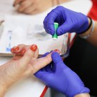 La prueba consiste en un sencillo test que se realiza con una gota de sangre del dedo.