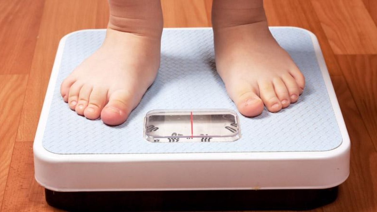 ¿Qué es la obesidad mórbida?