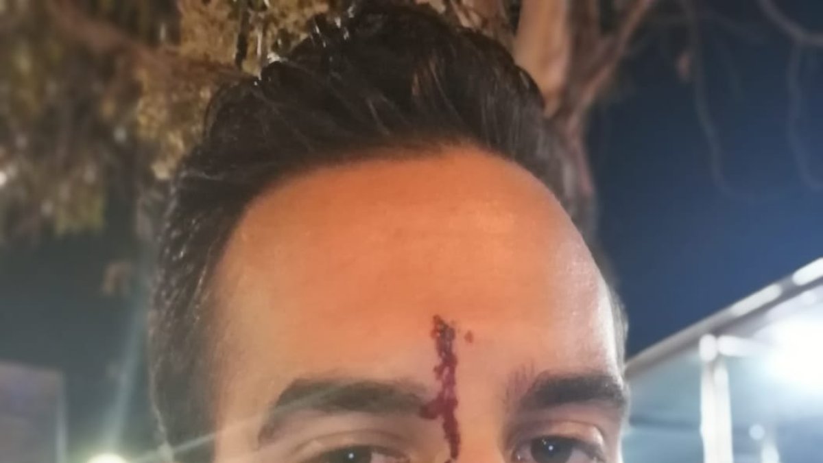 Xavi Martínez y su compañero han denunciado el ataque en los Mossos.