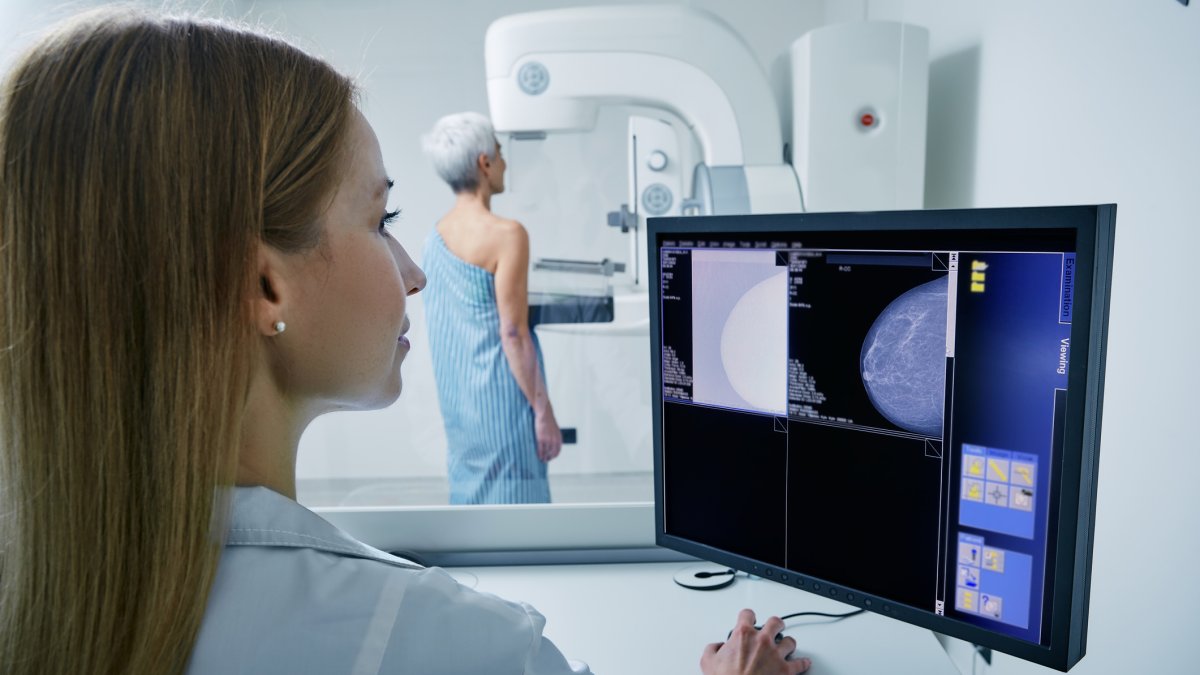 Técnico realiza un examen de mamografía a una paciente.