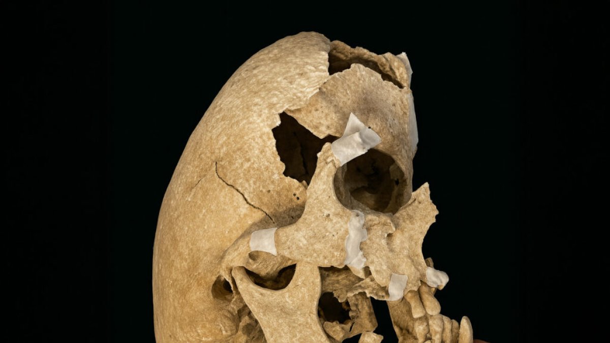 Los restos de un caballero de la Orden de Calatrava que padeció síndrome de Crouzon