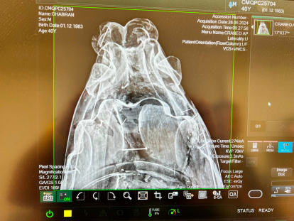 Detalle de una de las tomas de rayos X.